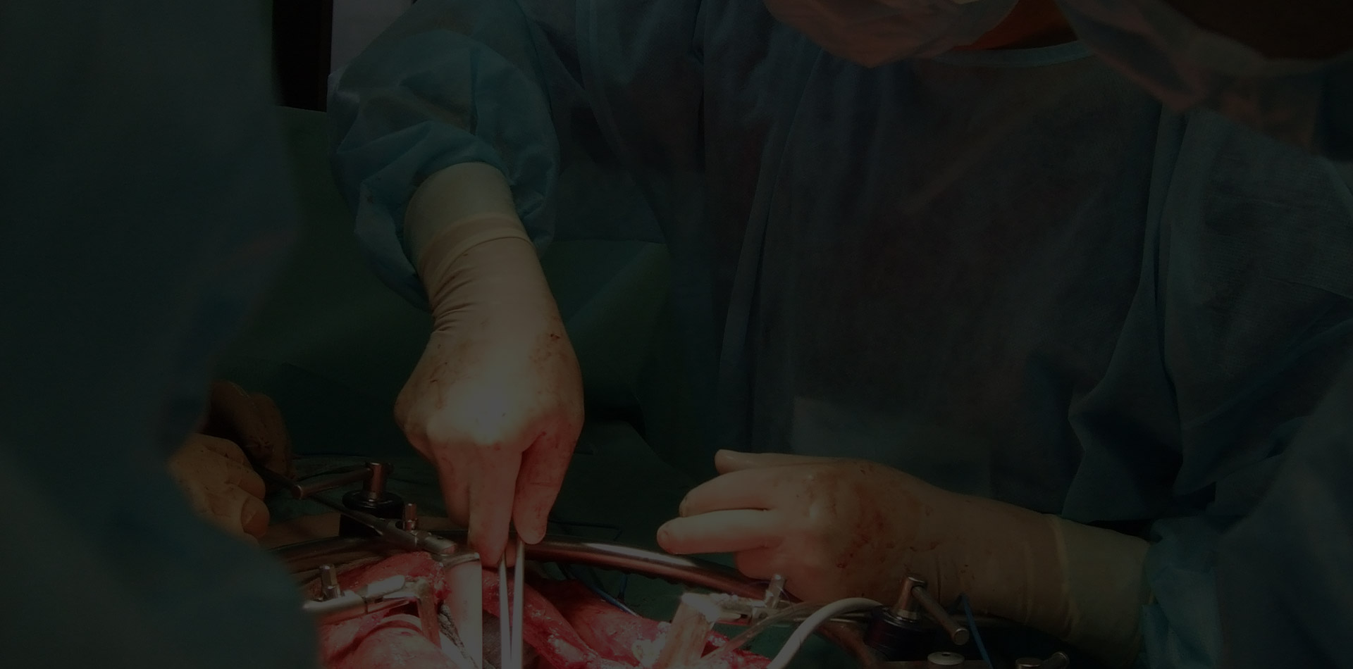 Advanced Anterior Scoliosis Techniques